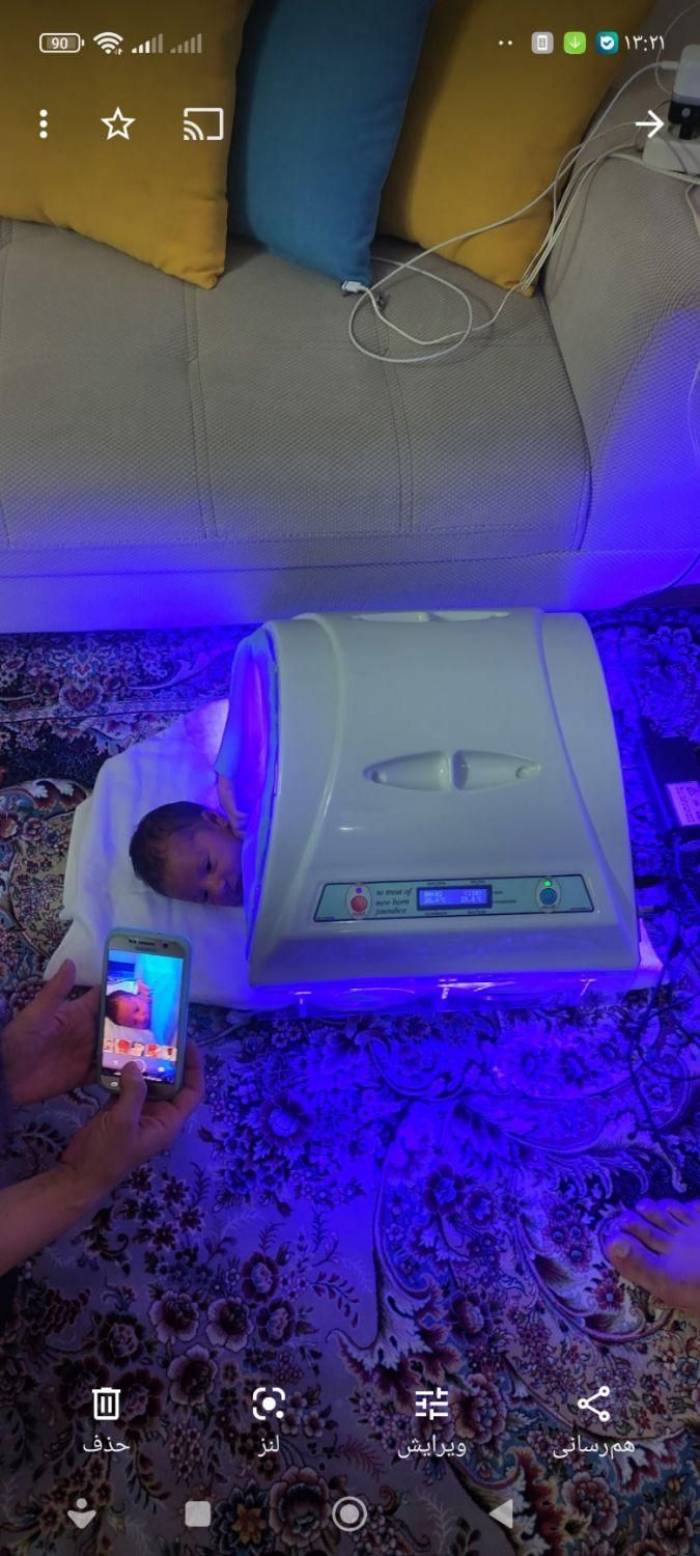 اجاره دستگاه زردی نوزاد شبانه روزی کل تهران